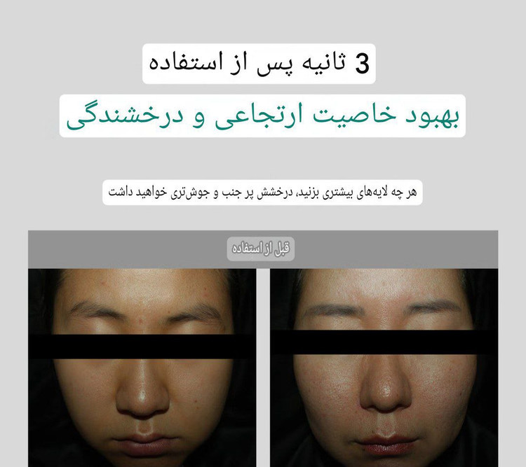 اسنس PDRN براق کننده برند VT