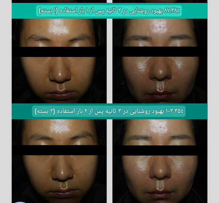 اسنس PDRN براق کننده برند VT