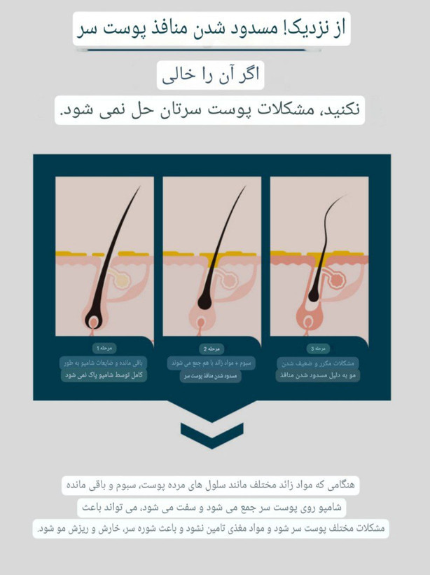 اسکراب خنک کننده و پاک کننده کف سر cp_1