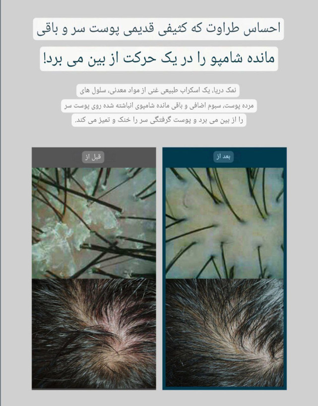 اسکراب خنک کننده و پاک کننده کف سر cp_1