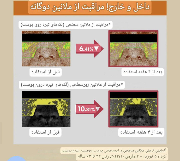 سرم ضدلک ویتامین سی برند راند لب