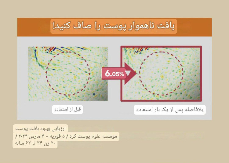 سرم ضدلک ویتامین سی برند راند لب
