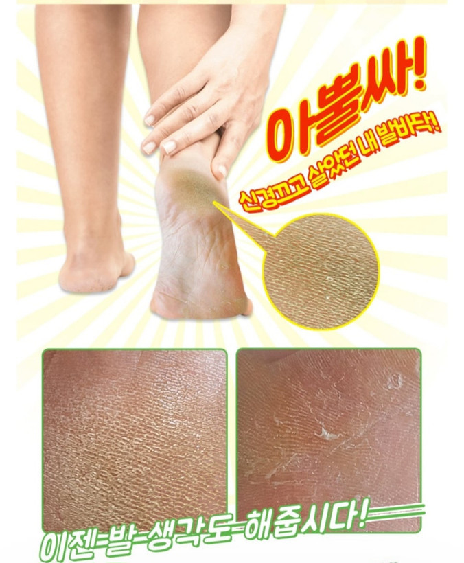 ماسک لایه بردار پا الیزاووکا