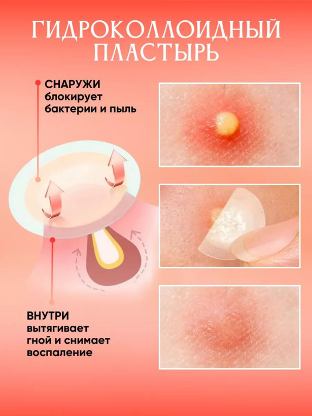 پچ جوش Withederm