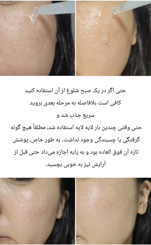 سرم تسکین دهنده سیکا AESTURA