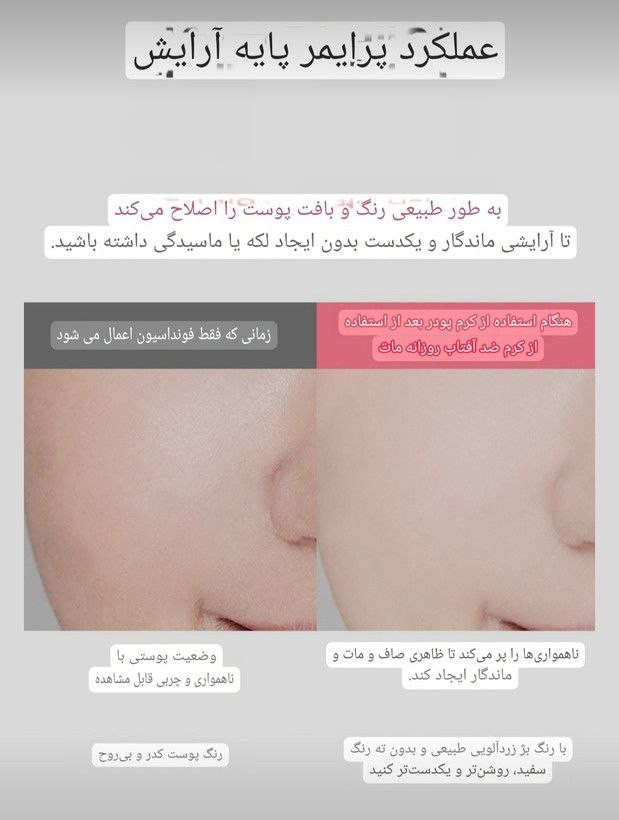ضدآفتاب تن آپ macqueen