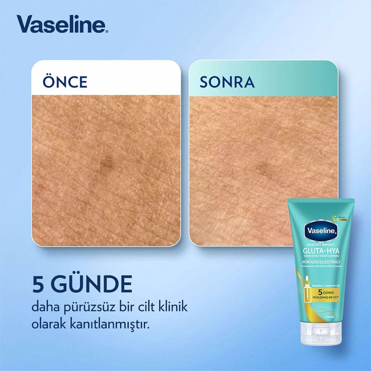 لوسیون بدن گلوتا-هیا مدل ضدجوش و لک Vaseline