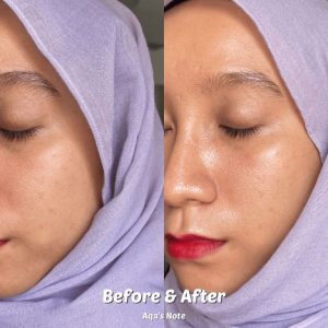 تونر آبرسان هیالورونیک ایزنتری