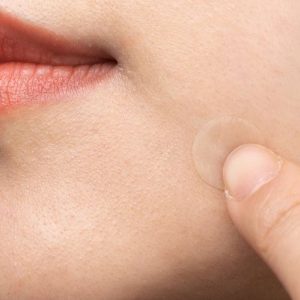 پچ های جوش هیدروکلوئید تیام