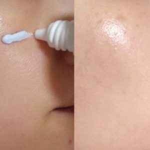 کرم ضدافتاب سیکا و آزولن برند بسیار معروف فوریت