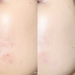 ضدآفتاب تن آپ بابونه نیچرریپابلیک