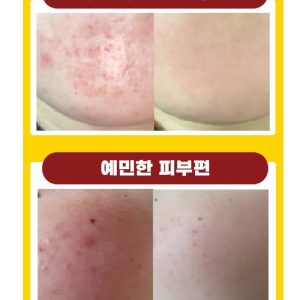 کرم sos‌‌ برطرف کننده مشکلات پوست