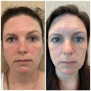 کرم مرطوب کننده ضدپیری سلول های بنیادی الاستیسیته سلول بنیادی گانگ اسکین