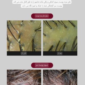 اسکراب کف سر نمک صورتی cp_1