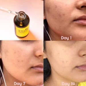 سرم نیاسین و آربوتین برند تیام