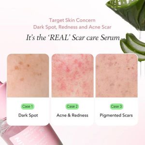 سرم آلوئه ورا صورتی آپریل اسکین