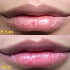 ماسک خواب لب افسنطین فرایجور