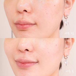 ضدآفتاب تن آپ دکتر جی 10 میل