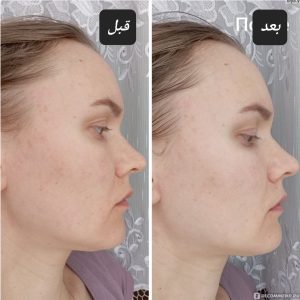 فوم نارگیل و سیکا گریس دی