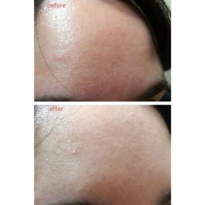 ماسک خواب پوره سیب زمینی اپیو