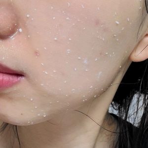 ژل لایه بردار ضدلک ریکوسل