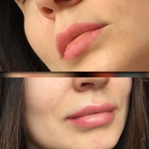 ماسک لب لانیژ فول سایز