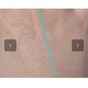 ضد آفتاب استیکی آبرسان توریدن