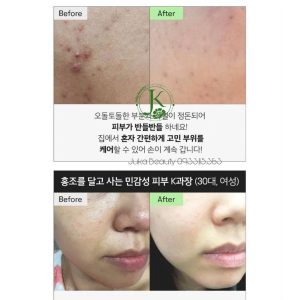 سرم نیدل شات سیکا dr.bargo